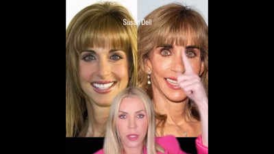 cosmetic doctor reacts to susan dells before and after photos